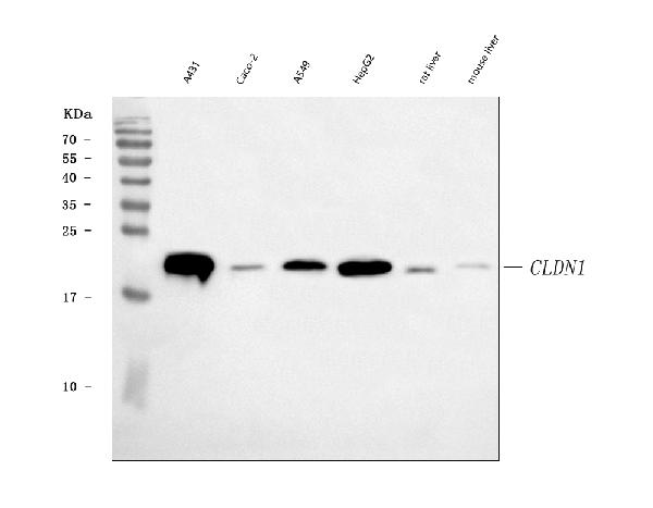 1 - Anti-Claudin 1 CLDN1 Rabbit Monoclonal Antibody ABO14010
