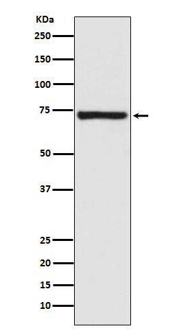 1 - Anti-Calpain 1 CAPN1 Rabbit Monoclonal Antibody ABO14011