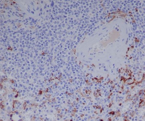 2 - Anti-Human IgG IGHG1 Rabbit Monoclonal Antibody ABO14012