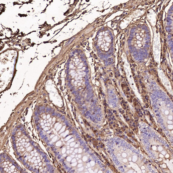 2 - Anti-Human IgG IGHG1 Rabbit Monoclonal Antibody ABO14012