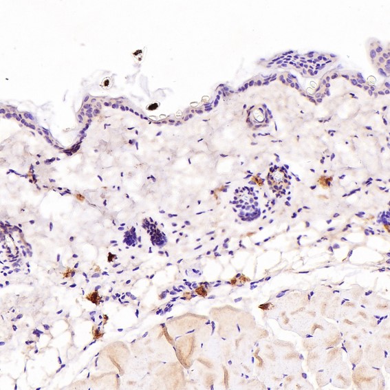 2 - Anti-Human IgG IGHG1 Rabbit Monoclonal Antibody ABO14012