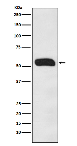 1 - Anti-Human IgG IGHG1 Rabbit Monoclonal Antibody ABO14012