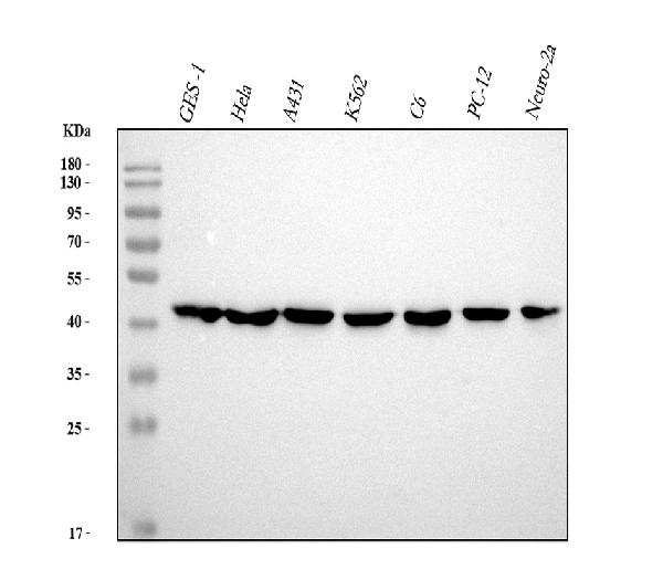 1 - Anti-beta Actin ACTB Rabbit Monoclonal Antibody ABO14013