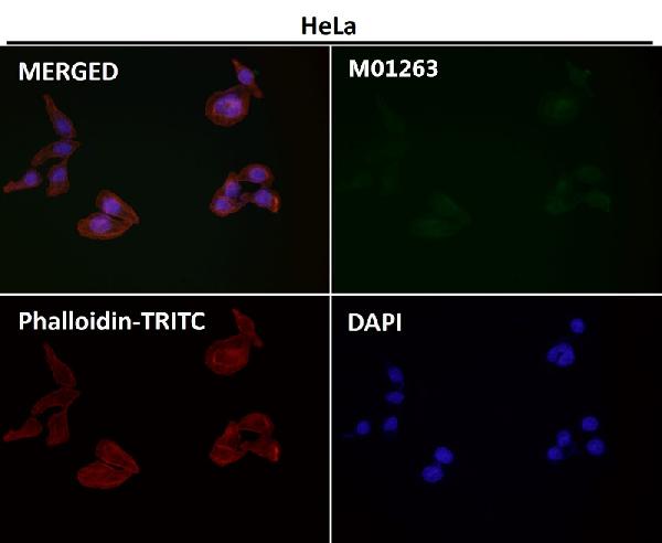 1 - Anti-beta Actin ACTB Rabbit Monoclonal Antibody ABO14013