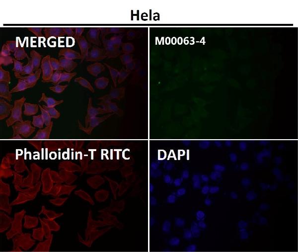 1 - Anti-E Cadherin Rabbit Monoclonal Antibody ABO14014