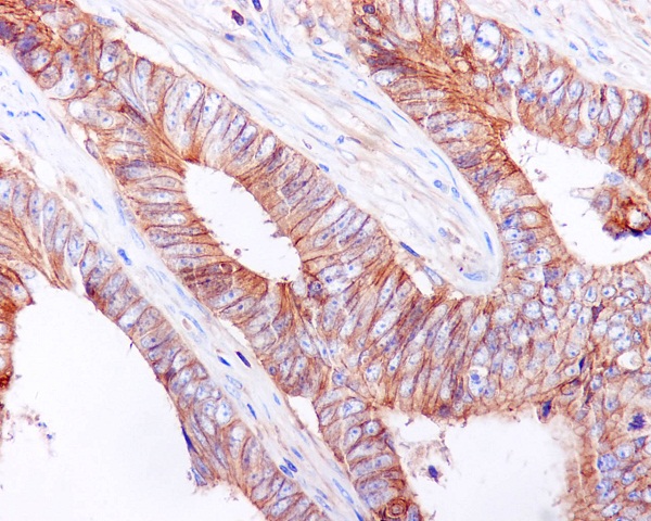 2 - Anti-E Cadherin Rabbit Monoclonal Antibody ABO14014