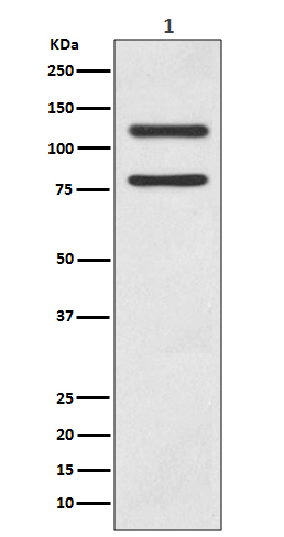 1 - Anti-E Cadherin Rabbit Monoclonal Antibody ABO14014