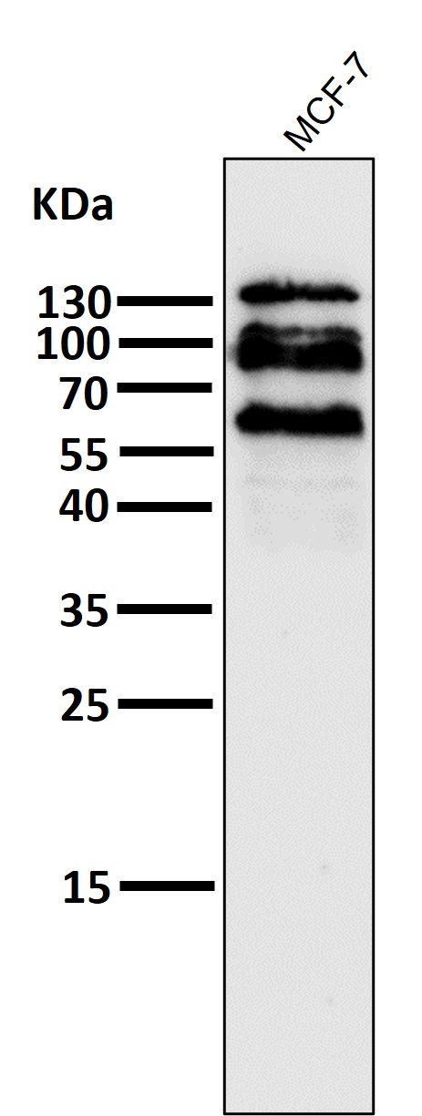 1 - Anti-E Cadherin Rabbit Monoclonal Antibody ABO14014