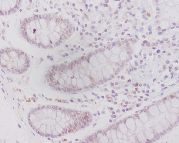 2 - Anti-Caveolin-2 CAV2 Rabbit Monoclonal Antibody ABO14015