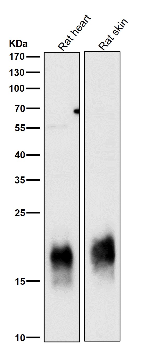 1 - Anti-Caveolin-3 CAV3 Rabbit Monoclonal Antibody ABO14016