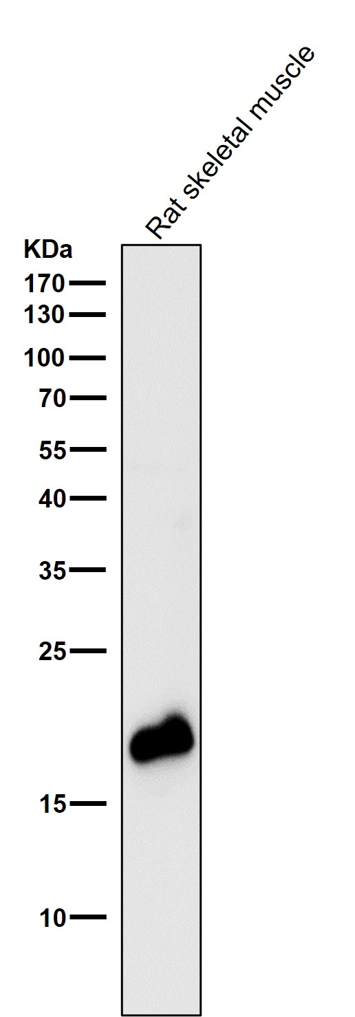 1 - Anti-Caveolin-3 CAV3 Rabbit Monoclonal Antibody ABO14016