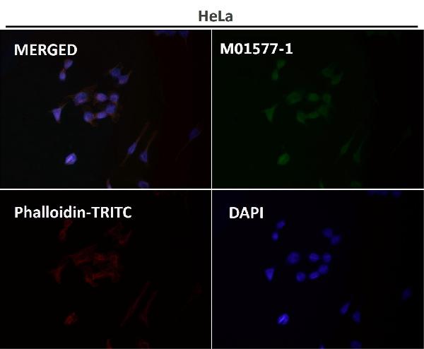 1 - Anti-N-Cadherin-2 CDH2 CD325-Rabbit Monoclonal Antibody ABO14018