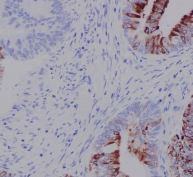 2 - Anti-N-Cadherin-2 CDH2 CD325-Rabbit Monoclonal Antibody ABO14018