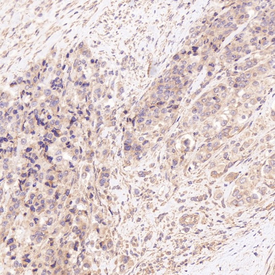 2 - Anti-N-Cadherin-2 CDH2 CD325-Rabbit Monoclonal Antibody ABO14018