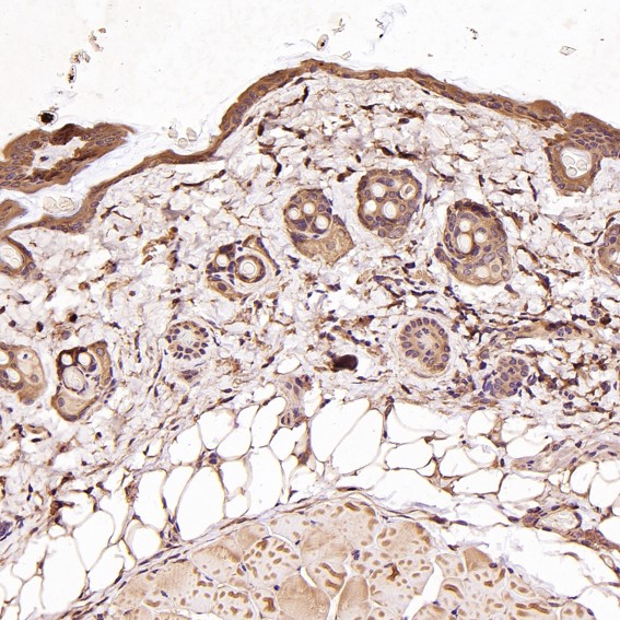2 - Anti-N-Cadherin-2 CDH2 CD325-Rabbit Monoclonal Antibody ABO14018