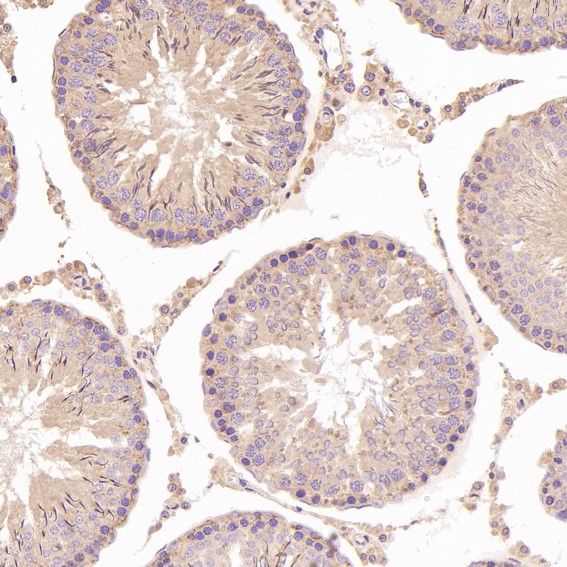 2 - Anti-N-Cadherin-2 CDH2 CD325-Rabbit Monoclonal Antibody ABO14018