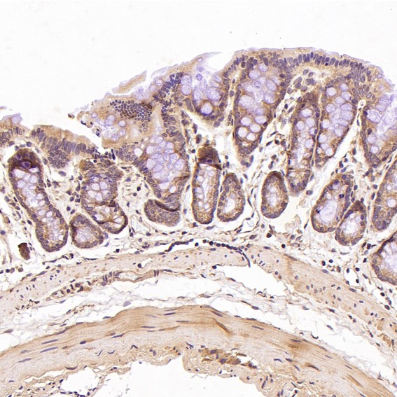 2 - Anti-N-Cadherin-2 CDH2 CD325-Rabbit Monoclonal Antibody ABO14018