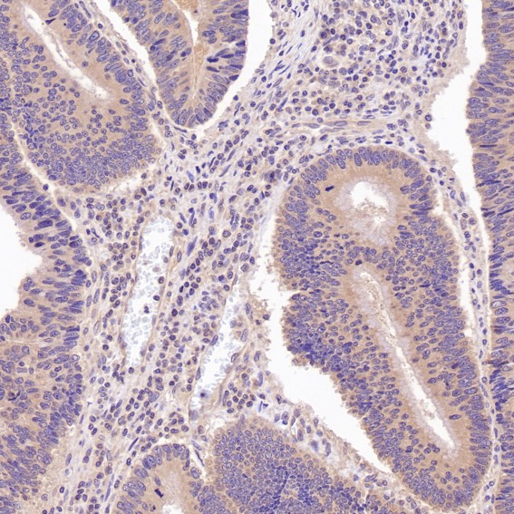 2 - Anti-N-Cadherin-2 CDH2 CD325-Rabbit Monoclonal Antibody ABO14018