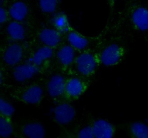 3 - Anti-Caveolin-1 CAV1 Rabbit Monoclonal Antibody ABO14019