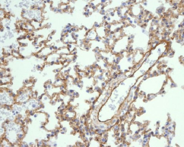 2 - Anti-Caveolin-1 CAV1 Rabbit Monoclonal Antibody ABO14019