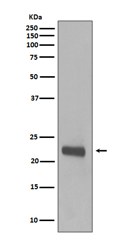 1 - Anti-Caveolin-1 CAV1 Rabbit Monoclonal Antibody ABO14019