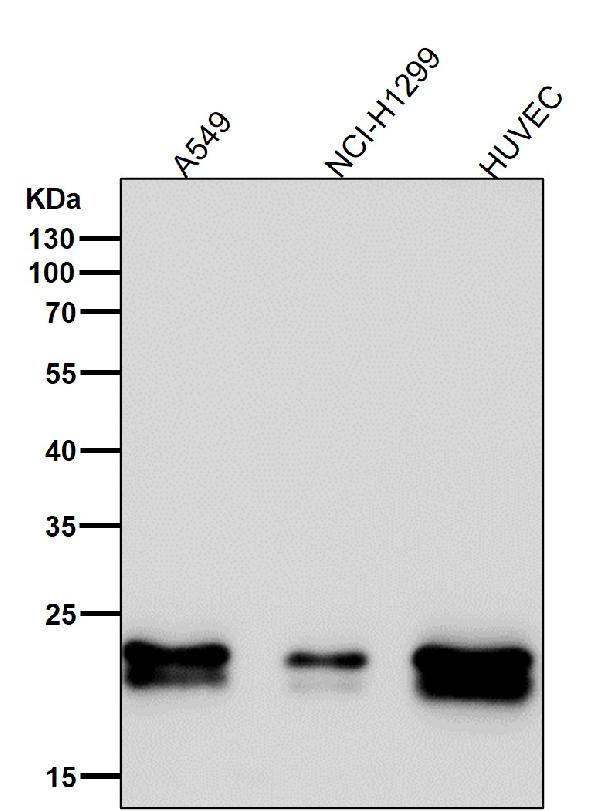 1 - Anti-Caveolin-1 CAV1 Rabbit Monoclonal Antibody ABO14019