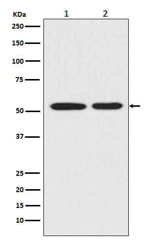1 - Anti-Mutant p53 Rabbit Monoclonal Antibody ABO14020