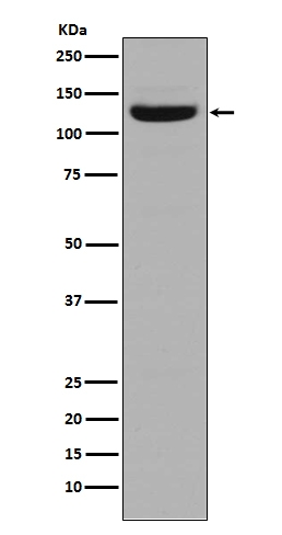 1 - Anti-Collagen I COL1A1 Rabbit Monoclonal Antibody ABO14021