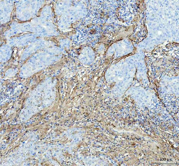 2 - Anti-Collagen I COL1A1 Rabbit Monoclonal Antibody ABO14021