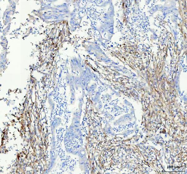 2 - Anti-Collagen I COL1A1 Rabbit Monoclonal Antibody ABO14021