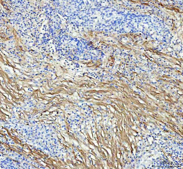 2 - Anti-Collagen I COL1A1 Rabbit Monoclonal Antibody ABO14021