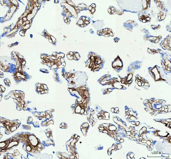 2 - Anti-Collagen I COL1A1 Rabbit Monoclonal Antibody ABO14021