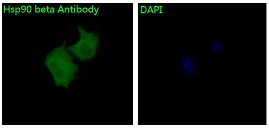 3 - Anti-Hsp90 beta HSP90AB1 Rabbit Monoclonal Antibody ABO14022
