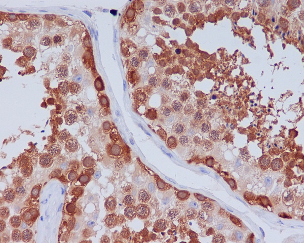 2 - Anti-Hsp90 beta HSP90AB1 Rabbit Monoclonal Antibody ABO14022