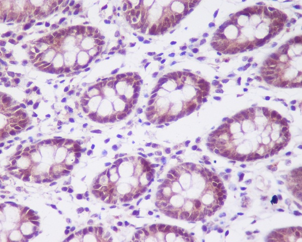 2 - Anti-CKII alpha CSNK2A1 Rabbit Monoclonal Antibody ABO14023