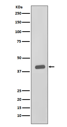 1 - Anti-CKII alpha CSNK2A1 Rabbit Monoclonal Antibody ABO14023
