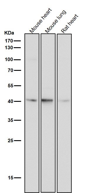 1 - Anti-CKII alpha CSNK2A1 Rabbit Monoclonal Antibody ABO14023