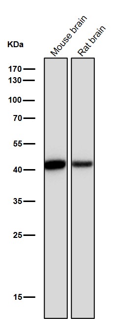 1 - Anti-CKII alpha CSNK2A1 Rabbit Monoclonal Antibody ABO14023