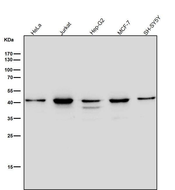 1 - Anti-CKII alpha CSNK2A1 Rabbit Monoclonal Antibody ABO14023