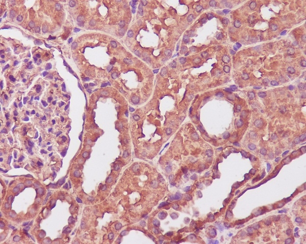 2 - Anti-Calmodulin Rabbit Monoclonal Antibody ABO14024