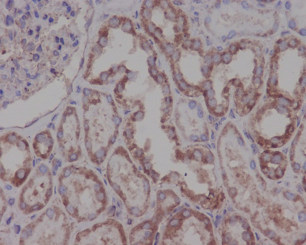 2 - Anti-Hsp90 beta HSP90AB1 Rabbit Monoclonal Antibody ABO14025
