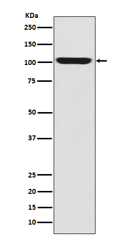 1 - Anti-LGR5/GPR49 Rabbit Monoclonal Antibody ABO14027