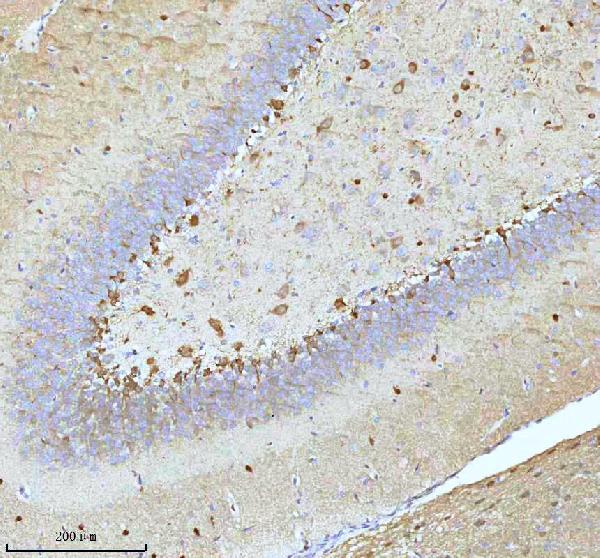 2 - Anti-Stathmin 1 STMN1 Rabbit Monoclonal Antibody ABO14029