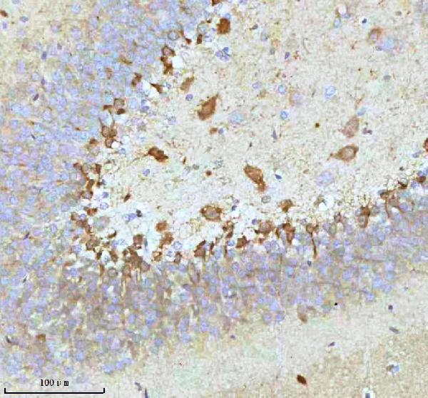 2 - Anti-Stathmin 1 STMN1 Rabbit Monoclonal Antibody ABO14029