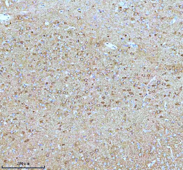 2 - Anti-Stathmin 1 STMN1 Rabbit Monoclonal Antibody ABO14029