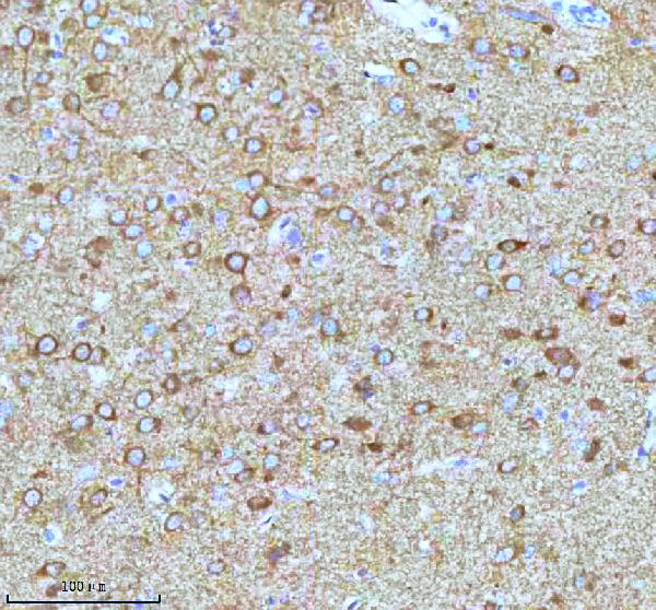 2 - Anti-Stathmin 1 STMN1 Rabbit Monoclonal Antibody ABO14029