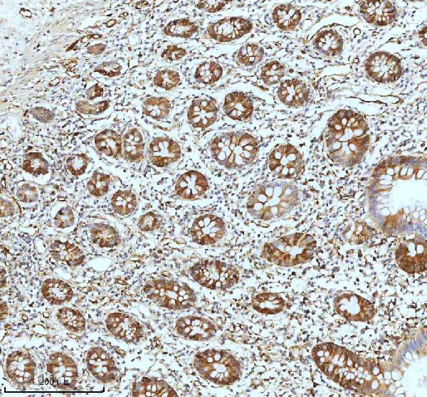 2 - Anti-Stathmin 1 STMN1 Rabbit Monoclonal Antibody ABO14029