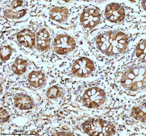 2 - Anti-Stathmin 1 STMN1 Rabbit Monoclonal Antibody ABO14029