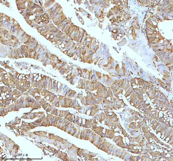 2 - Anti-Stathmin 1 STMN1 Rabbit Monoclonal Antibody ABO14029