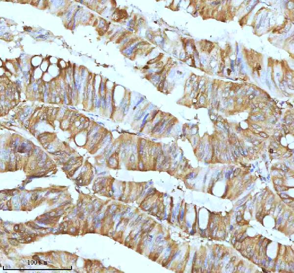 2 - Anti-Stathmin 1 STMN1 Rabbit Monoclonal Antibody ABO14029